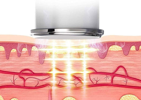 Renji EMS Nackenmassagegerät mit Wärmefunktion – Elektrischer Nacken- & Schultermassager, tragbar & wiederaufladbar, 15 Intensitätsstufen