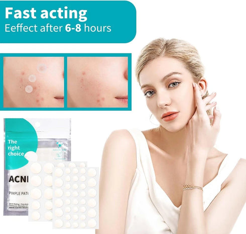 Pickelpflaster 330 Stück – Unsichtbare Hydrokolloidpflaster für reine Haut