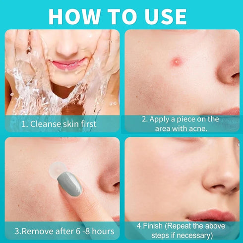 Pickelpflaster 330 Stück – Unsichtbare Hydrokolloidpflaster für reine Haut