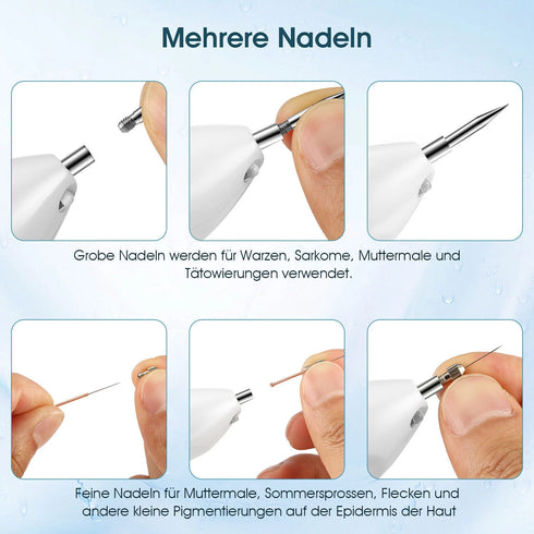 Remover Pen für Muttermale