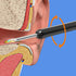 Intelligenter sichtbarer Earpick