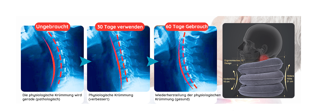 FlexiNacken - Der ultimative Nackenstretcher für mehr Wohlbefinden